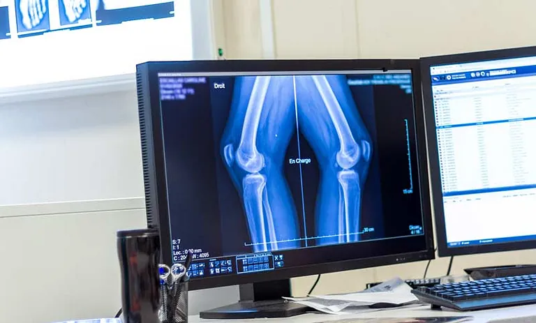Röntgenuntersuchung vom Knie in Graz